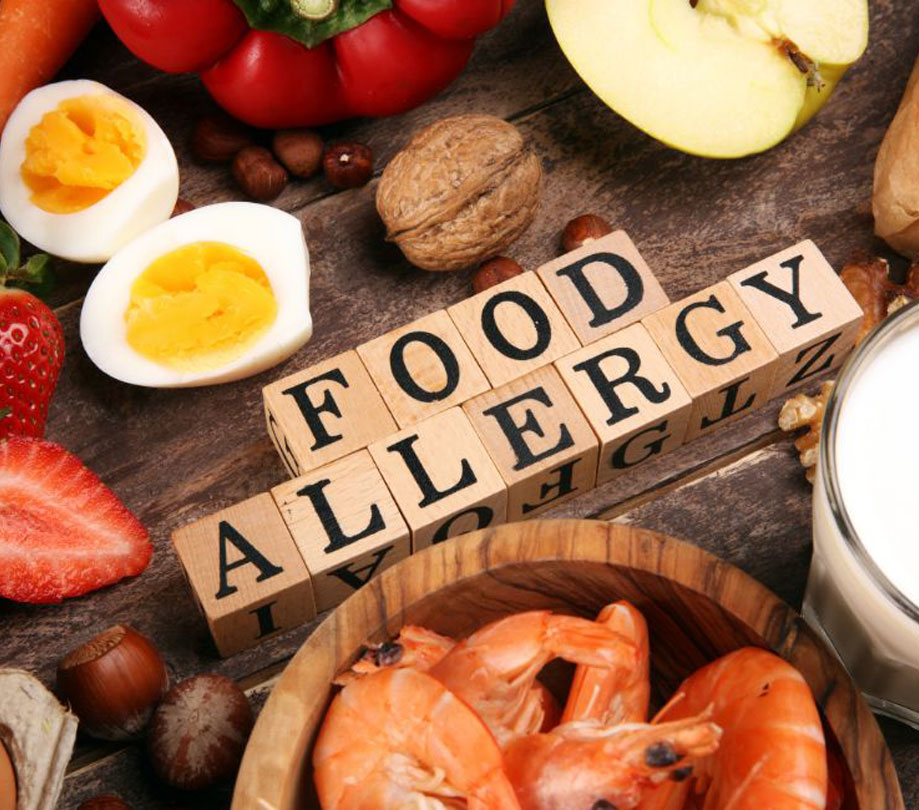 Customer Food Allergies